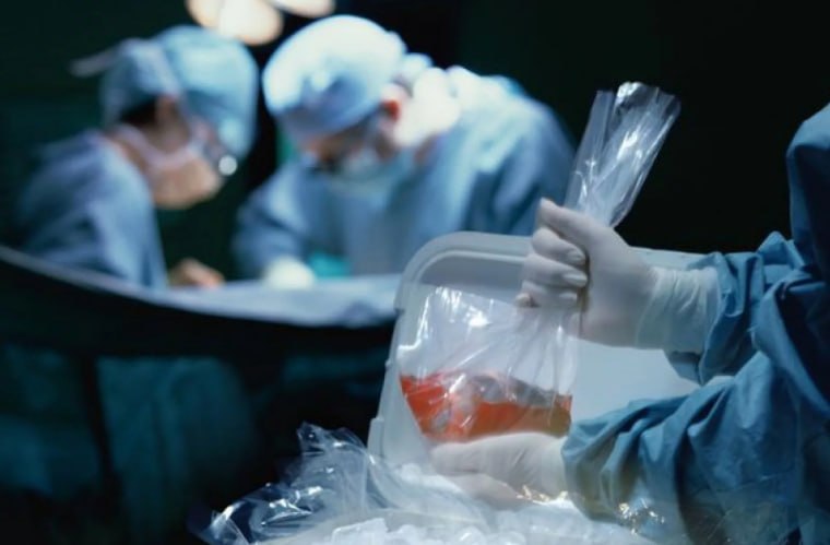 O‘zbekistonda xususiy klinikalarga organlarni transplantatsiya qilishga ruxsat beriladi